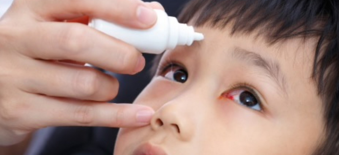 Child with eye irritation